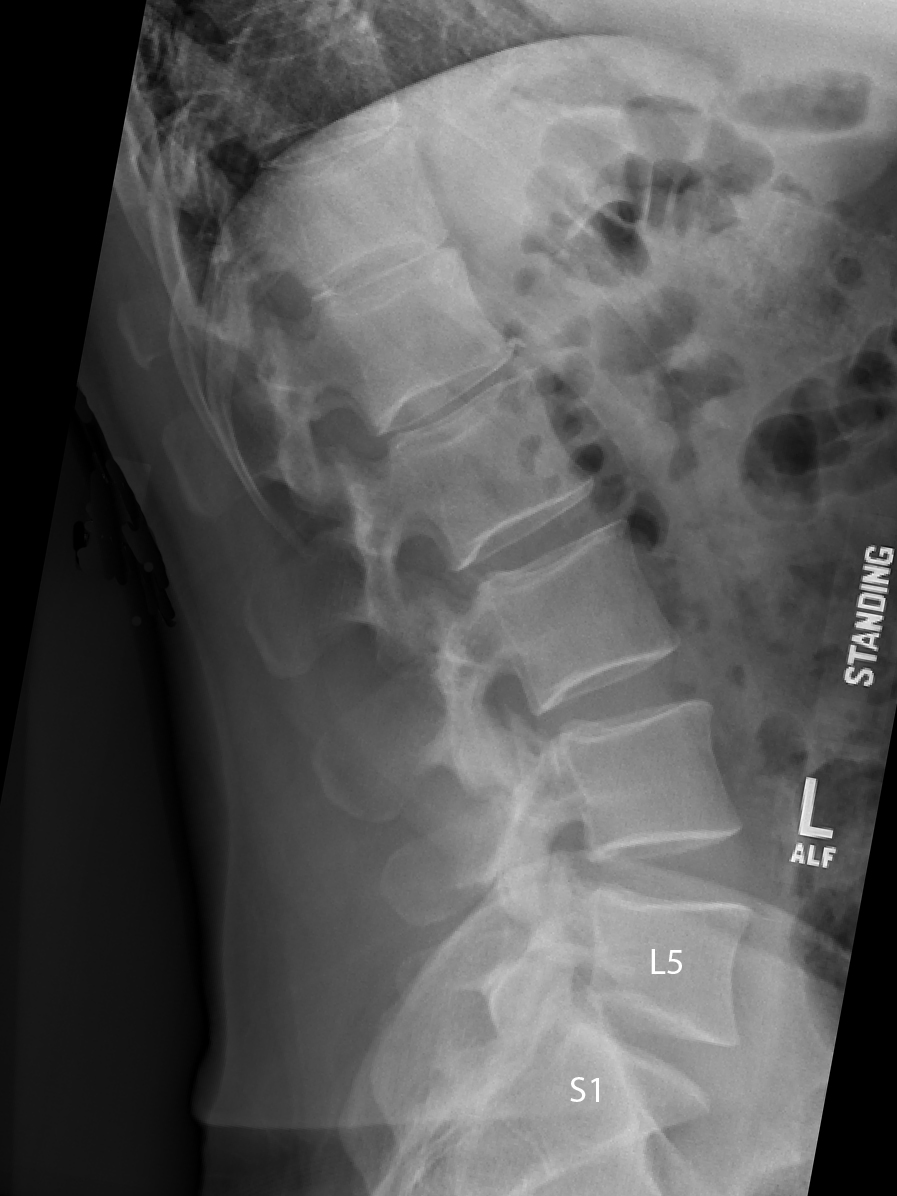 X-ray